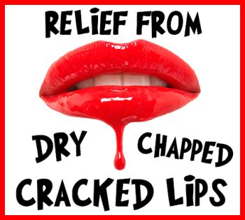 Arlington dentist, Dr. Hawkins at Crown Dentistry, tells you how to relieve your dry, chapped, and cracked lips!