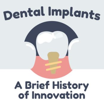 Arlington dentist, Dr. Kasey Hawkins of Crown Dentistry discusses dental implants and shares some information about their history.