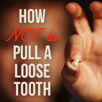 Arlington dentist, Dr. Kasey Hawkins at Crown Dentistry, tells parents the do’s and don’ts of pulling your child’s loose baby teeth for the safest and most painless experience.