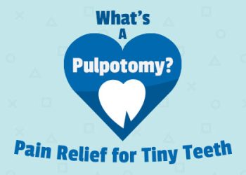 Arlington dentist, Dr. Hawkins of Crown Dentistry, explains what a pulpotomy is, when they’re recommended, and the steps of the procedure for saving baby teeth.