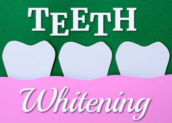 Arlington dentist, Dr. Kasey Hawkins at Crown Dentistry shares everything you need to know about different types of teeth whitening