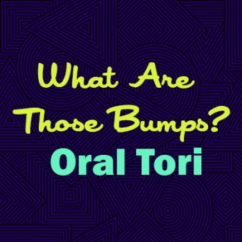 Arlington dentist, Dr. Hawkins at Crown Dentistry, explains oral tori—what they are, why they happen, and whether they are a cause for concern.