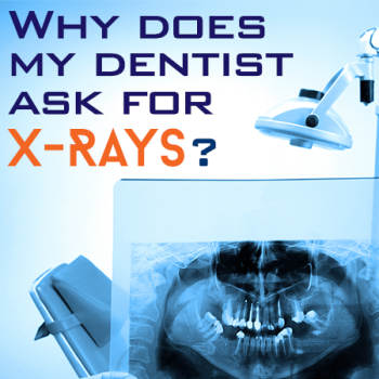 Arlington dentist, Dr. Kasey Hawkins at Crown Dentistry, discusses the importance of dental x-rays for accurate diagnosis and treatment planning.